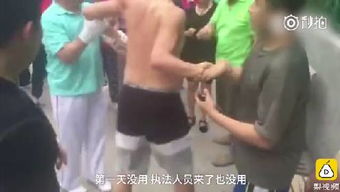 老人制止施暴鼻子被咬掉 伤情披露